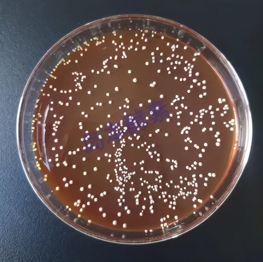 菌肥中常用菌株大揭秘，科学使用助丰收